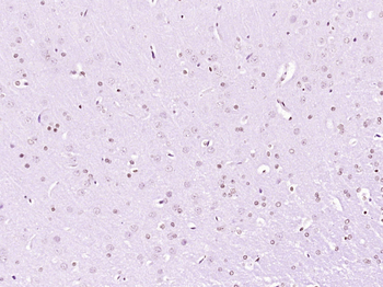 Phospho-DDX5 (Tyr593) Rabbit Polyclonal Antibody