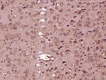 Phospho-delta 1 Catenin (Ser268) Rabbit Polyclonal Antibody