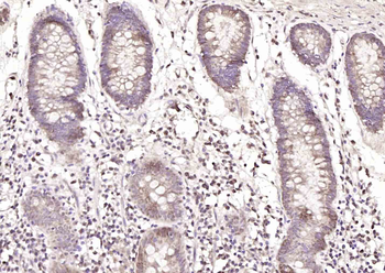 Phospho-delta 1 Catenin (Thr916) Rabbit Polyclonal Antibody