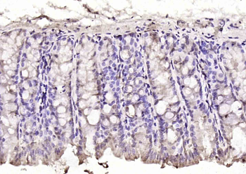 Phospho-delta 1 Catenin (Thr916) Rabbit Polyclonal Antibody