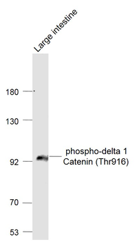 Phospho-delta 1 Catenin (Thr916) Rabbit Polyclonal Antibody