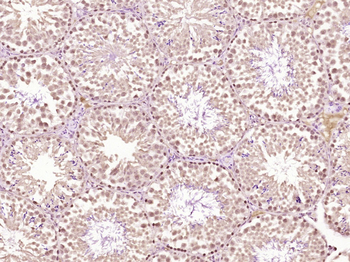 Phospho-delta 1 Catenin (Tyr228) Rabbit Polyclonal Antibody