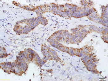 DERLIN-1 Rabbit Polyclonal Antibody