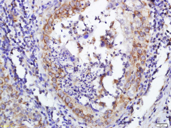 DERLIN-1 Rabbit Polyclonal Antibody