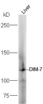 DIM-7 Rabbit Polyclonal Antibody