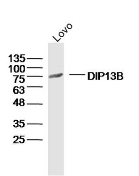 DIP13B Rabbit Polyclonal Antibody