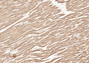 DLST Rabbit Polyclonal Antibody