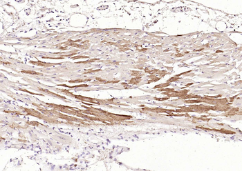 DLST Rabbit Polyclonal Antibody