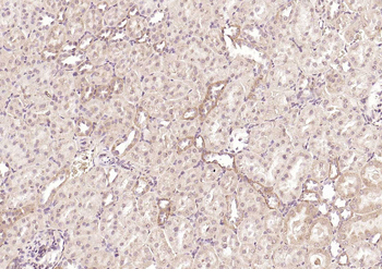 DLST Rabbit Polyclonal Antibody