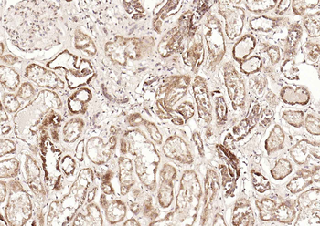 DLST Rabbit Polyclonal Antibody