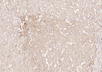 DLST Rabbit Polyclonal Antibody