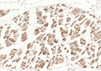 DLST Rabbit Polyclonal Antibody