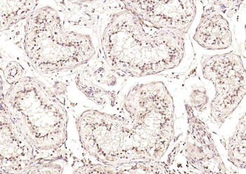 DLST Rabbit Polyclonal Antibody
