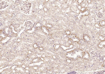 DLST Rabbit Polyclonal Antibody