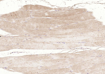 DLST Rabbit Polyclonal Antibody