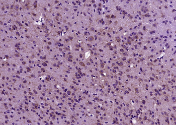 DMPK Rabbit Polyclonal Antibody