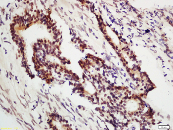 POLG Rabbit Polyclonal Antibody