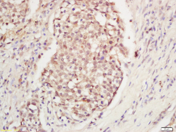 POLG Rabbit Polyclonal Antibody