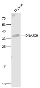DNAJC9 Rabbit Polyclonal Antibody