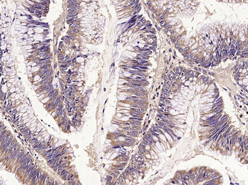 E cadherin Rabbit Polyclonal Antibody
