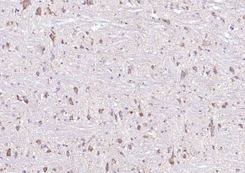 E cadherin Rabbit Polyclonal Antibody