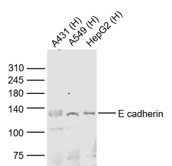 E cadherin Rabbit Polyclonal Antibody