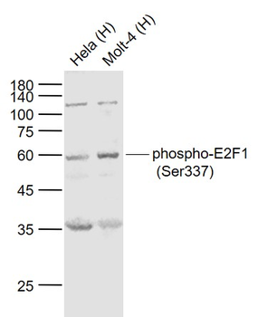 Phospho-E2F1 (Ser337) Rabbit Polyclonal Antibody