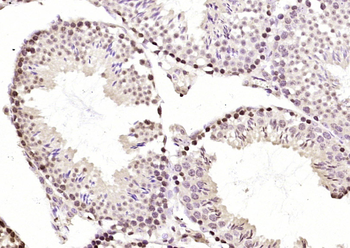 EEF1D Rabbit Polyclonal Antibody