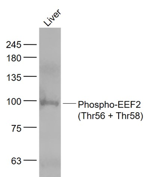 Phospho-EEF2 (Thr56 + Thr58) Rabbit Polyclonal Antibody