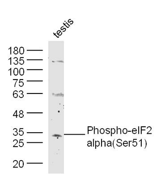 Phospho-EIF2S1 (Ser51) Rabbit Polyclonal Antibody