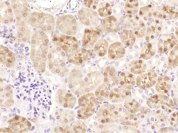 AGO2 Rabbit Polyclonal Antibody