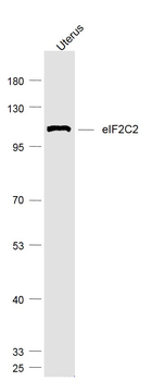 AGO2 Rabbit Polyclonal Antibody