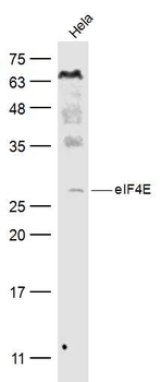 EIF4E Rabbit Polyclonal Antibody