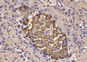 EIF5 Rabbit Polyclonal Antibody
