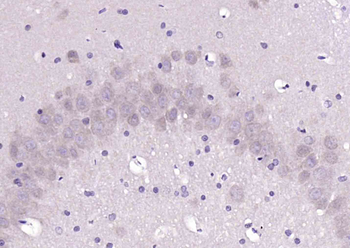 ELAVL2 + ELAVL4 Rabbit Polyclonal Antibody