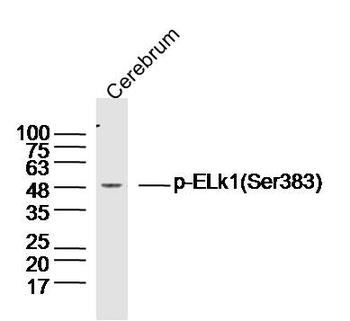 Phospho-ELk1 (Ser383) Rabbit Polyclonal Antibody