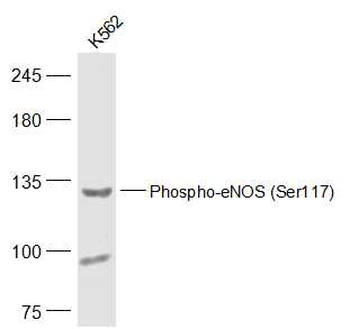 Phospho-eNOS (Ser117) Rabbit Polyclonal Antibody