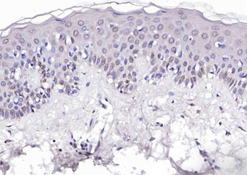 EP300 Rabbit Polyclonal Antibody