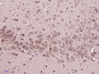 Epac1 Rabbit Polyclonal Antibody
