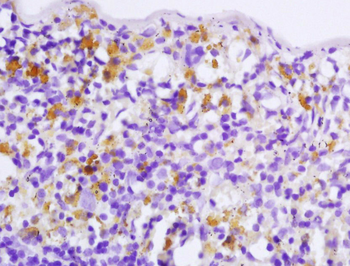 EPB41 Rabbit Polyclonal Antibody