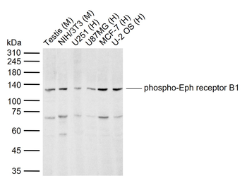 Phospho-Eph receptor B1 (Tyr928) Rabbit Polyclonal Antibody