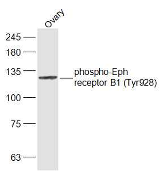 Phospho-Eph receptor B1 (Tyr928) Rabbit Polyclonal Antibody