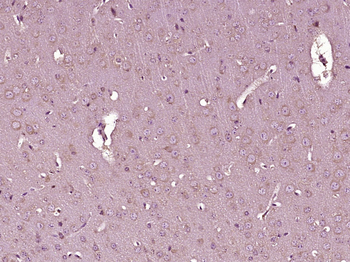 Phospho-Eph receptor B1 (Tyr968) Rabbit Polyclonal Antibody