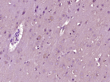 Phospho-Eph receptor B1 (Tyr968) Rabbit Polyclonal Antibody