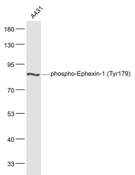 Phospho-Ephexin-1 (Tyr179) Rabbit Polyclonal Antibody