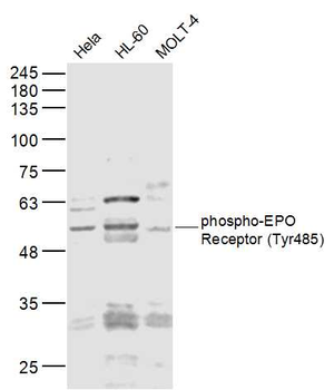 Phospho-EPO Receptor (Tyr485) Rabbit Polyclonal Antibody