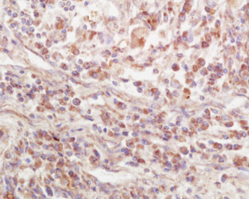 EPS15R Rabbit Polyclonal Antibody