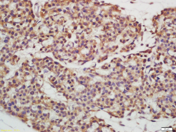 EPS15R Rabbit Polyclonal Antibody