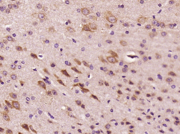 Epsin 2 Rabbit Polyclonal Antibody