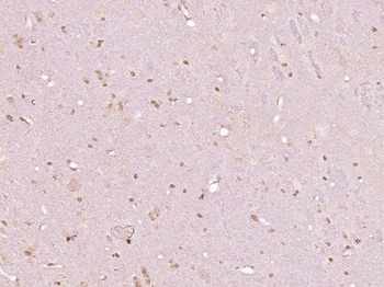 ERCC8 Rabbit Polyclonal Antibody